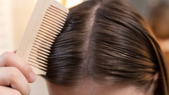 El vinagre de manzana brinda bastantes beneficios al organismo, como regular el pH, eliminar células muertas, reducir de várices e incluso blanquear los dientes. | Imagen ilustrativa / Web