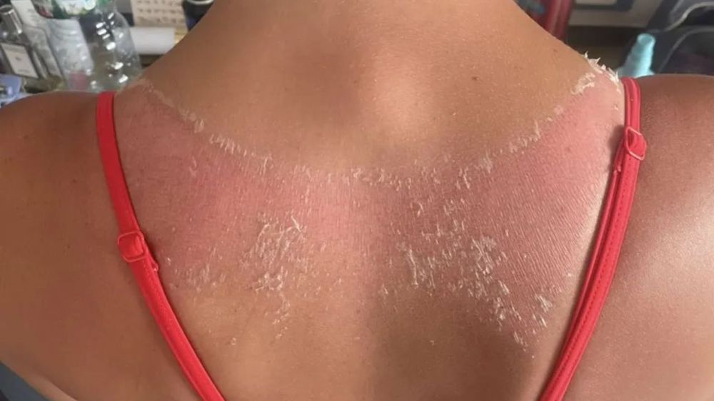 Compró un top por $7.000 en Shein y casi se le derrite la piel.