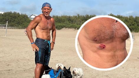Un vendedor ambulante lo mordió tras una pelea en Pinamar y lo denunció, pero cuando supo que el hombre podría quedarse sin trabajo intervino para ayudarlo. Foto: Twitter