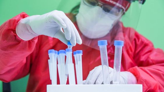 Análisis exprés. Los test de antígenos son la última incorporación en la provincia para dar con infecciones del coronavirus. Foto: Mariana Villa / Los Andes.