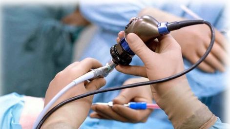 Programa nacional de detección precoz  del cáncer de colon - Por Jorge Carlos Milutin