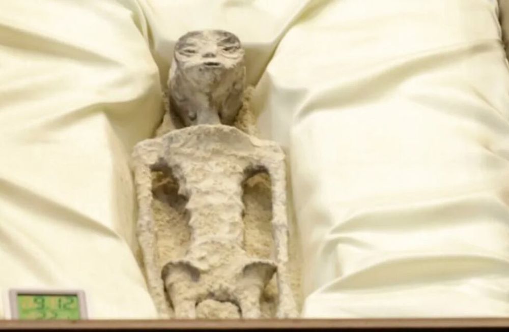 Los resultados de la radiografía mostraron objetos extraños al interior del cuerpo del presunto alien. Gentileza: Captura @RonyVernet.