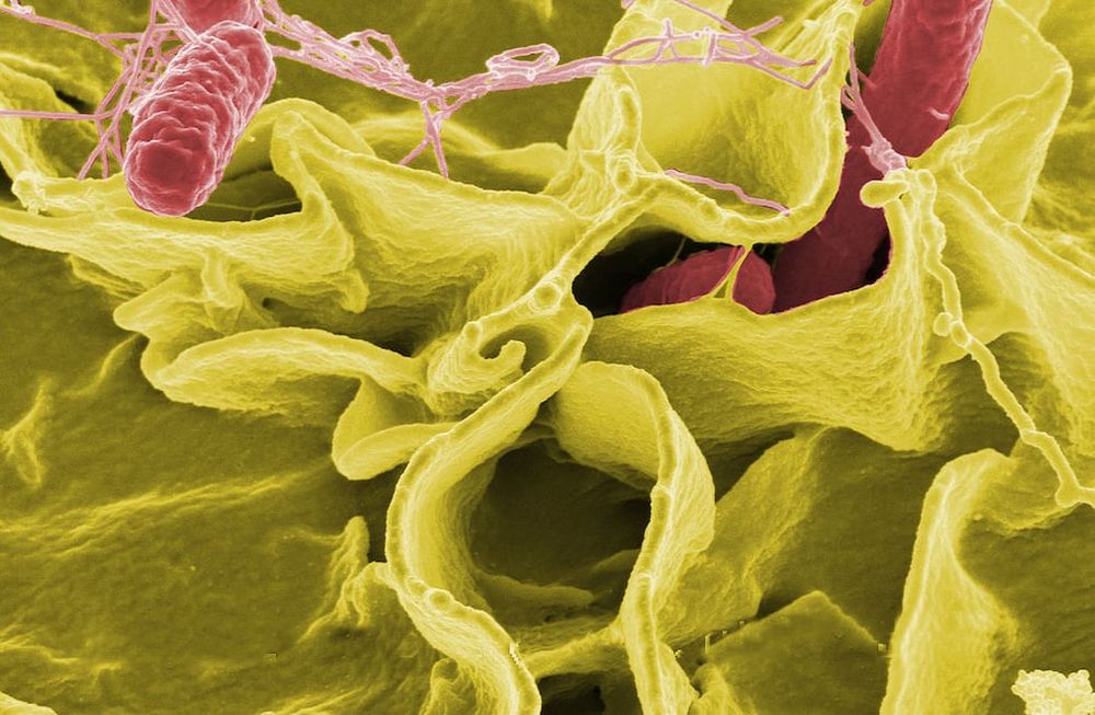 Qué es la salmonela y por qué puede ser mortal para un bebé