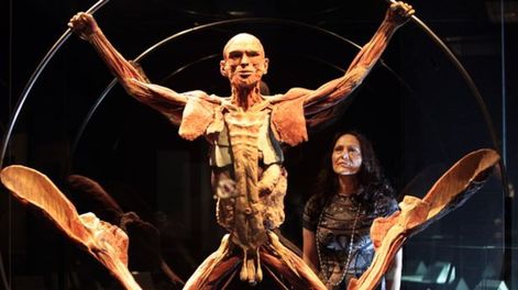 El terrorífico museo de cadáveres de Berlín sigue abierto por orden judicial