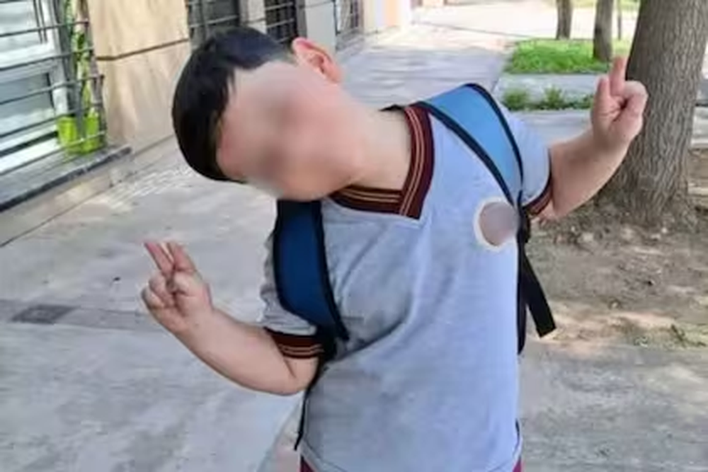 Bastián Jerez sigue grave y en terapia