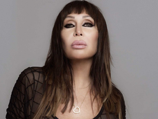 Moria Casán pidió que no se difundan fotos de ella usando bastón.