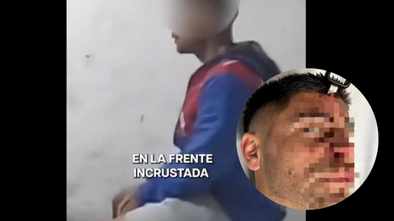 Imágenes sensibles: le clavaron una lleva e auto en la frente en medio de una pelea en un torneo de fútbol