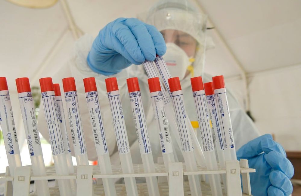 Mejoras. La cantidad de casos se redujo a la mitad, también hay una notoria disminución en el número de fallecidos. Foto: Orlando Pelichotti / Los Andes.