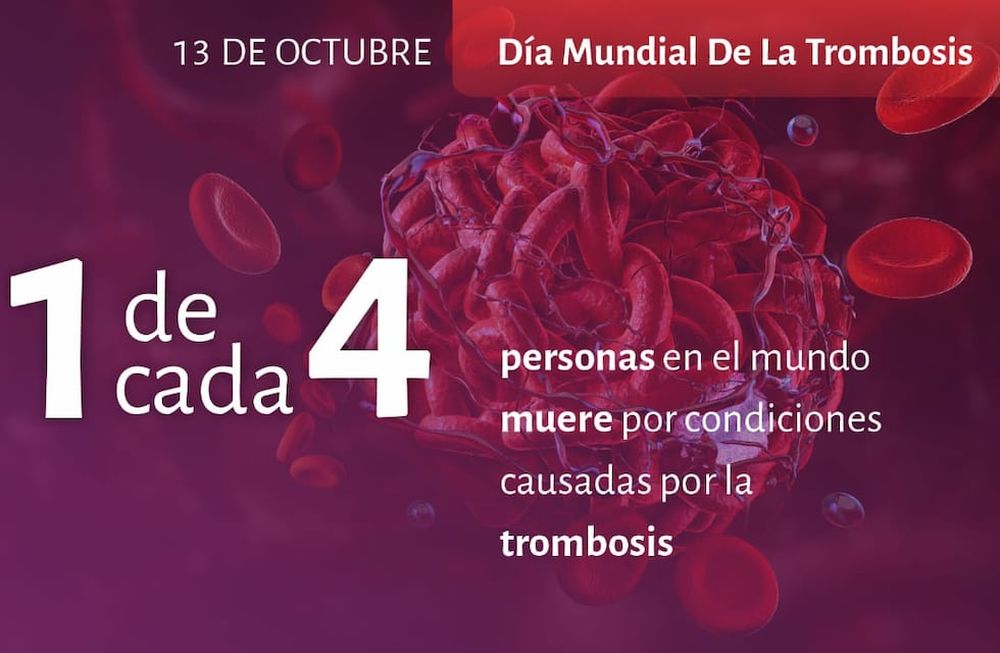 13 de Octubre: Día Mundial de la Trombosis