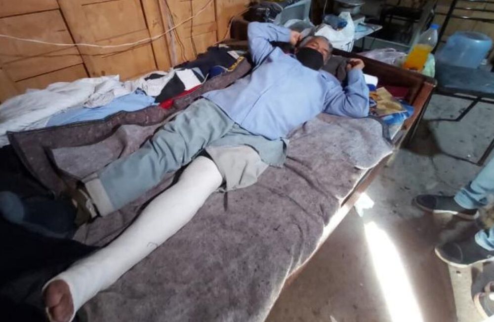 Gregorio no tenía el celular ni mucho dinero por lo que el delincuente decidió golpearlo hasta que le quebró la pierna. Foto: Gentileza El Doce.