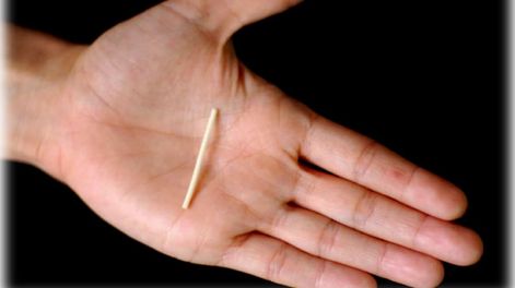 Nuevo anticonceptivo para adolescentes de alto riesgo