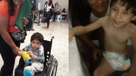 Los Andes | Francismo Marinozzi (6) tiene sirenomelia (sus pies están unidos) y una insuficiencia renal. Necesita ayuda para tener su bici adaptada a medida.