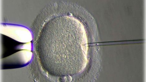 Fecundación in vitro: el caso Murillo