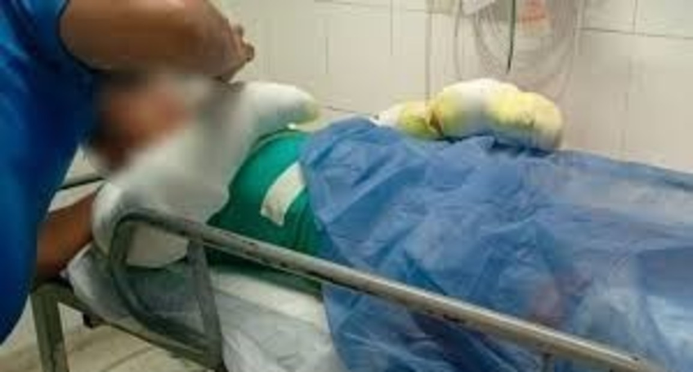 Un adolescente de 16 años sufrió quemaduras en el 60% de su cuerpo luego de que le explotó el celular.