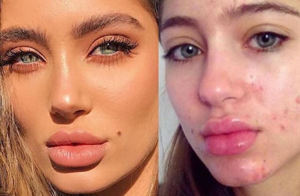 Una nueva ley prohíbe que los influencers y modelos utilicen filtros para borrar imperfecciones ya que transmite un mensaje erróneo de la realidad.
