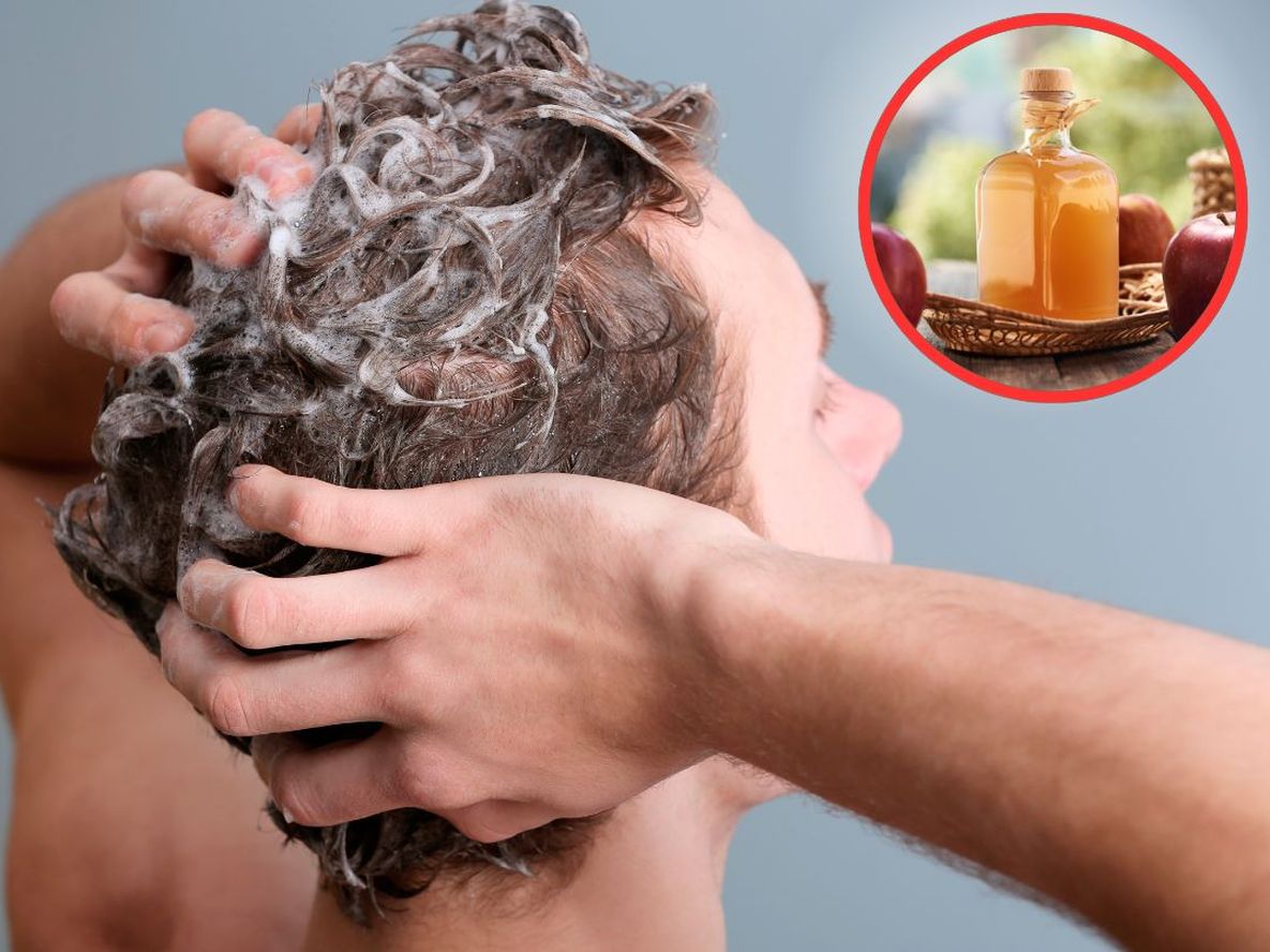 El vinagre debe estar siempre diluido en agua para evitar irritaciones, especialmente en cueros cabelludos sensibles.