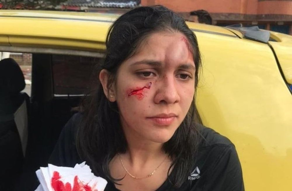 Una mujer recibió un botellazo en su rostro, cuando le pidió a un hombre que dejara de agredirla verbalmente.