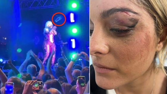 Agredieron en un show en vivo a la artista Bebe Rexha arrojándole un celular en la cara en Nueva York.
