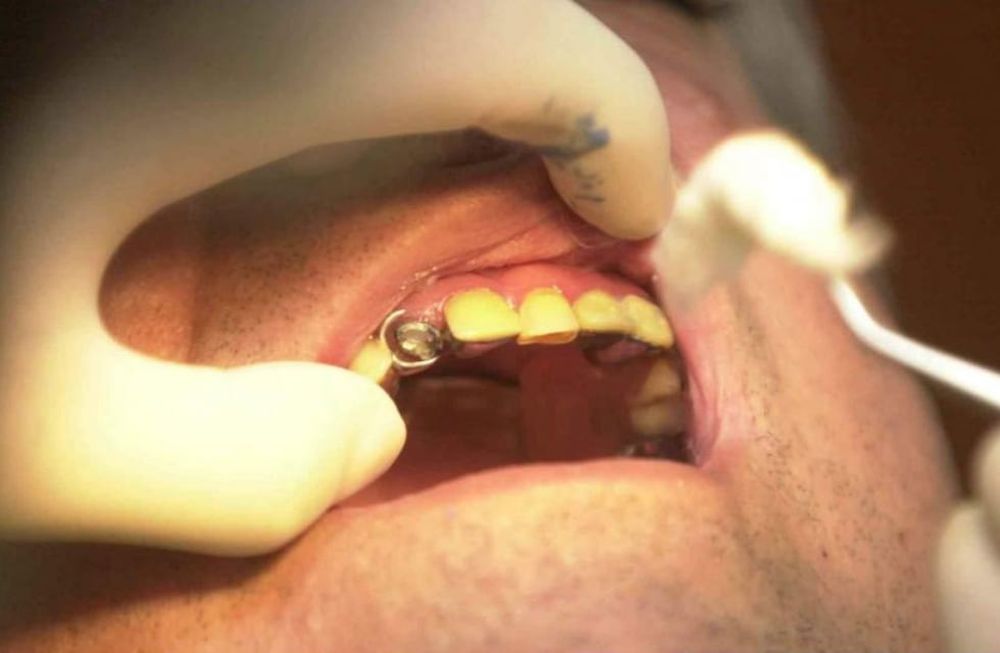 La odontofobia es el miedo intenso y persistente a los dentistas o a la atenci&oacute;n dental.&nbsp; Foto: Archivo