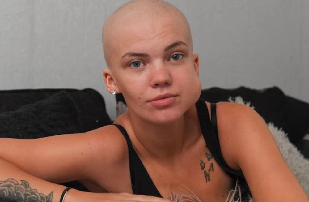Kimberley Eccles (23) tiene cáncer y le avisaron por Zoom: pasó meses sin tratamiento por el Covid-19 - The Sun