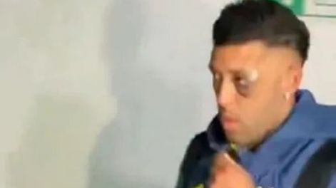 El ojo lastimado de Janson, jugador de Boca Juniors. / Gentileza.