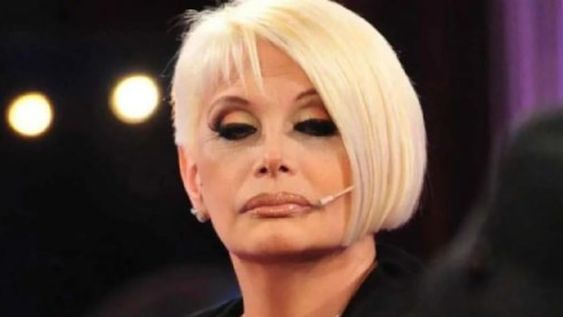 Impactan las imágenes del rostro de Carmen Barbieri con culebrilla