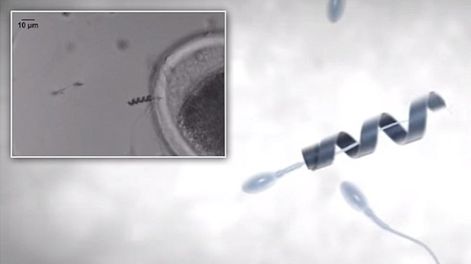 El ‘Spermbot’ podría ser una solución para la astenospermia. Foto: Web