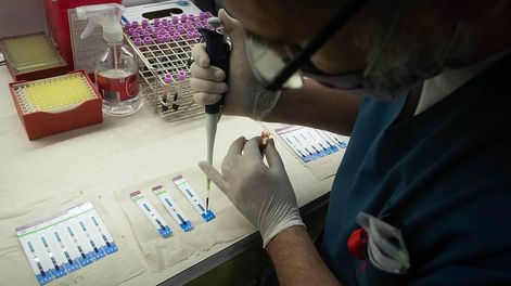 Los Andes | El Gobierno realiza la campaña Elegí Saber, en el Día Internacional de la Respuesta al VIHLa iniciativa que tiene como objetivos promover la accesibilidad al diagnóstico para reducir la cantidad de diagnósticos tardíos, seguir promoviendo el testeo de mu