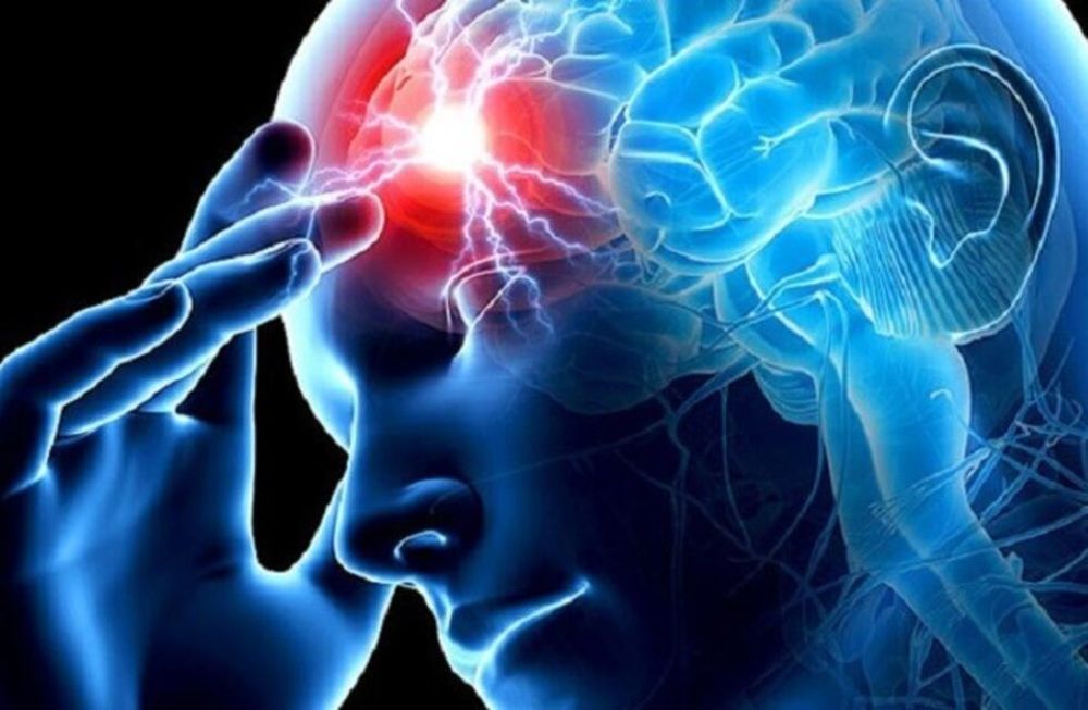 El accidente cerebrovascular es una de las principales causas de muerte y discapacidad en el mundo.