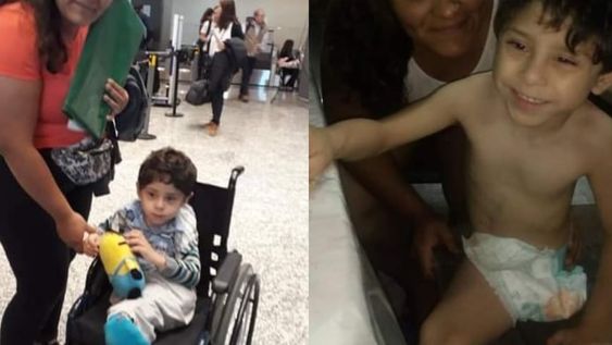 Francismo Marinozzi (6) tiene sirenomelia (sus pies están unidos) y una insuficiencia renal. Necesita ayuda para tener su bici adaptada a medida.