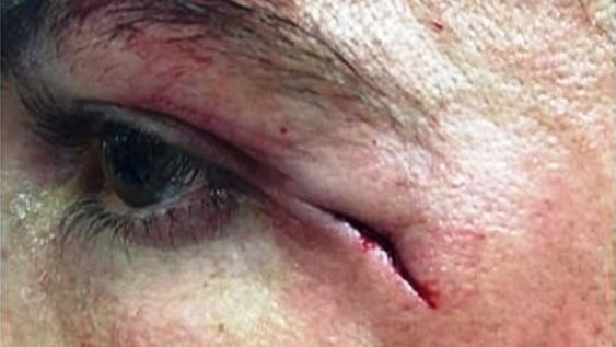 Mirá como le quedó el rostro a Cristiano tras el corte que sufrió por una patada