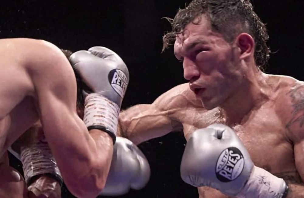 Juan Carrasco terminó con los ojos absolutamente inflamados, signos de una pelea feroz en Arena Aconcagua frente al ruso Abdullaev que lo superó por nocaut.