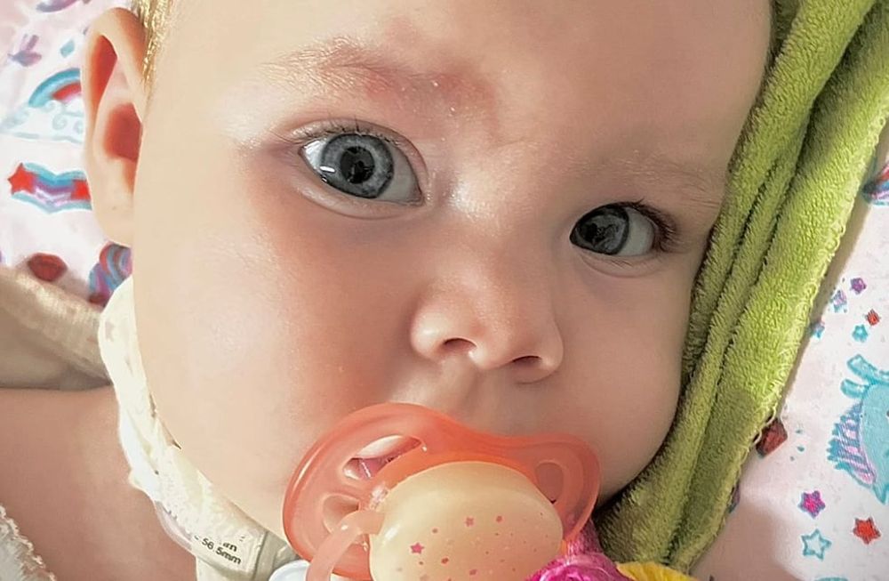 Ludmi, la niña mendocina que nació con una rara enfermedad comenzó su tratamiento: “Podemos decir que lo logramos”. Foto: Gentileza Yanina Bressa.