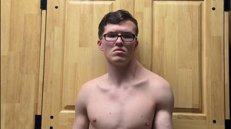 El sorprendente cambio físico de un joven que entrena los músculos de un solo lado de su cuerpo.