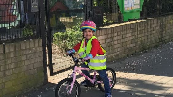 La nena de aspecto angelical y sana desde el exterior, tiene un trastorno genético llamado alcaptonuria, o enfermedad de los huesos negros.