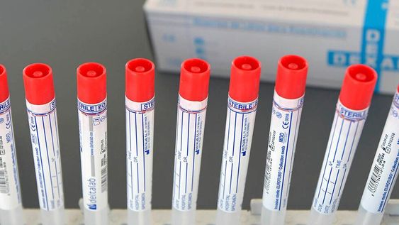 Un hombre de 38 años que vive en San Luis se convirtió en el primer caso confirmado de Covid-19 con la variante Ómicron en Argentina. Además de él, hay cuatro contactos estrechos aislados. Foto: Orlando Pelichotti / Los Andes.