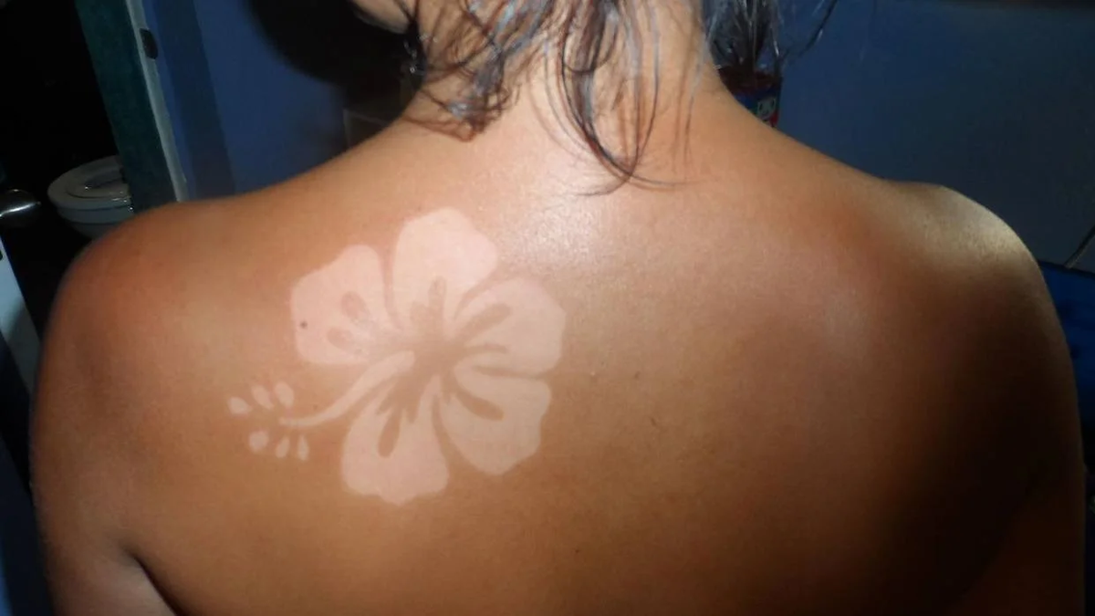 La tendencia viral que se espera para el verano y preocupa a los dermatólogos