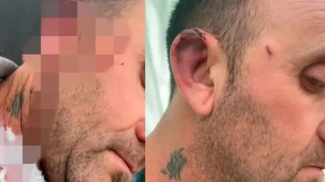 Los Andes | Escándalo en Entre Ríos: un concejal golpeó al intendente durante una reunión y terminó con el rostro ensangrentado