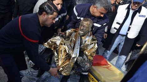 Los Andes | Varios peatones intentan ayudar a un hombre, después de que este se prendiera fuego, en el centro de Túnez. Gentileza / rfi