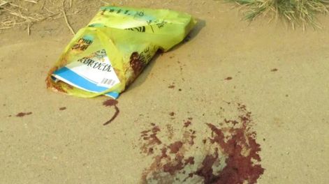 Fue un ataque con cuchillo, un asalto intencional, dijo la policía.
