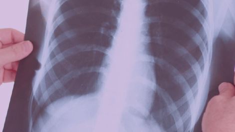 Los Andes | MB6654ETWZBQNN237WRCPJMKMY.jpg?quality=75&smart=true&auth=5cd3a52377db3cfcf6bab842b40f732cf8dc7d723db0cc187b45481c3780f79e&width=980&height=640