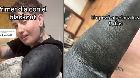 Los Andes | La joven enseñó el resultado del blackout / roma_chambers