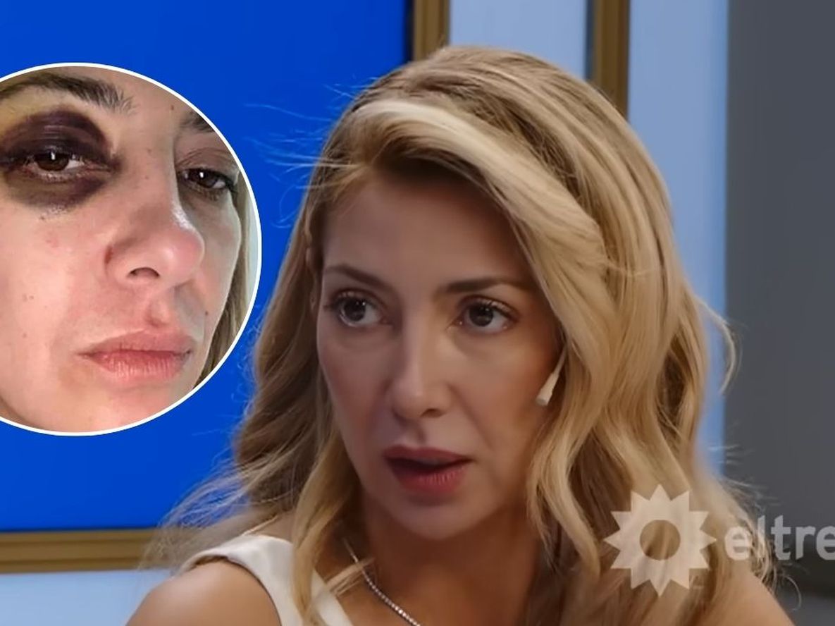 Las revelaciones de Fabiola Yañez sobre la noche que Alberto Fernández la golpeó: Dijo que fue involuntario.