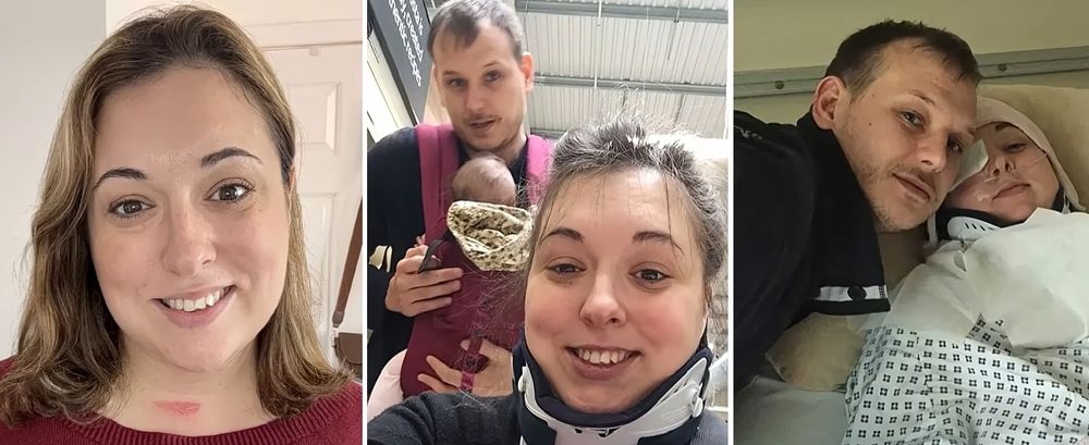 Hayley Black, madre de dos hijos, vivió un accidente insólito cuando un bostezo fuerte le rompió el cuello, dejándola con secuelas permanentes y una cirugía urgente.