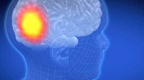 Hipersensibles - Por Rosa Montero