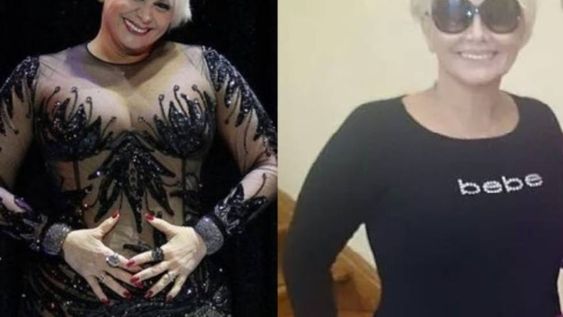 Carmen Barbieri se hará otro combo de cirugías estéticas