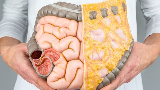 El colorrectal es la tercera causa de cáncer en la Argentina