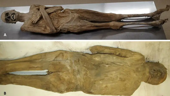 Aspecto externo de la momia desde las caras ventral (A) y dorsal (B), mostrando una pared corporal completamente intacta.
