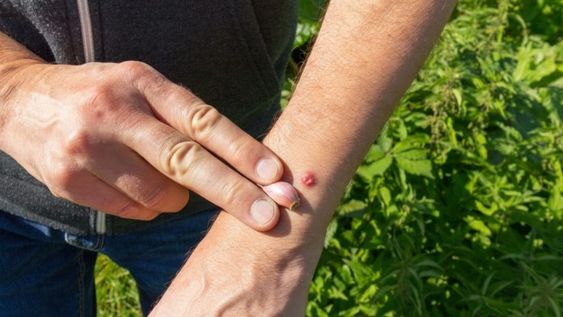 El ajo es una opción práctica para una acción rápida ante las picaduras de mosquitos.