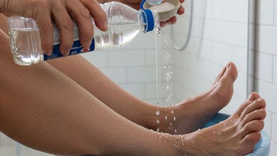 Usada con moderación y constancia, esta mezcla se convierte en una solución para los pies.